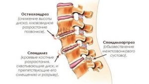 Позвоночник и суставы