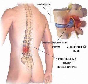 Позвоночник и суставы