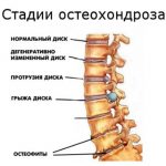 Позвоночник и суставы